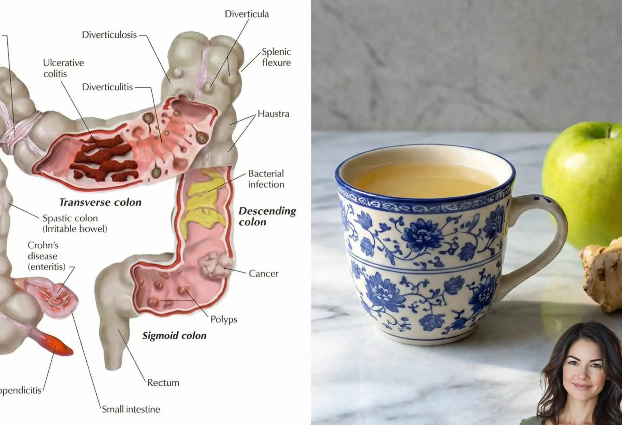 Succo che Pulice il Colon e Libera l'Intestino